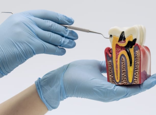 Endodontie unter dem Mikroskop